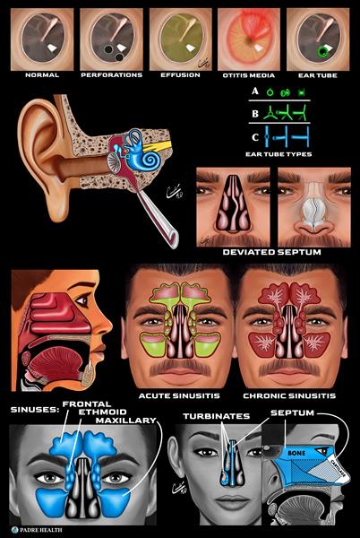 Ear--Nose--Septum--Sinuses by Padre Health