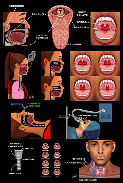 Nose--throat--tongue--airway--thyroid-and-neck by Padre Health